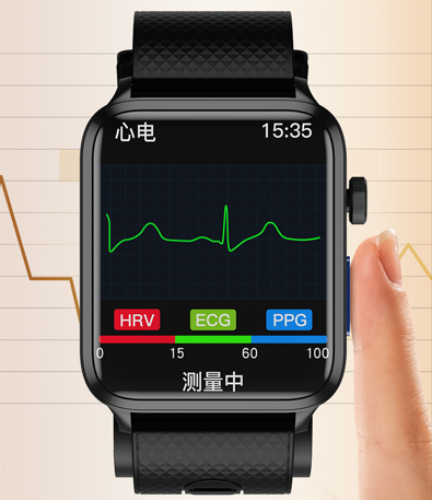 AI-Powered ECG Analysis & Disease Screening